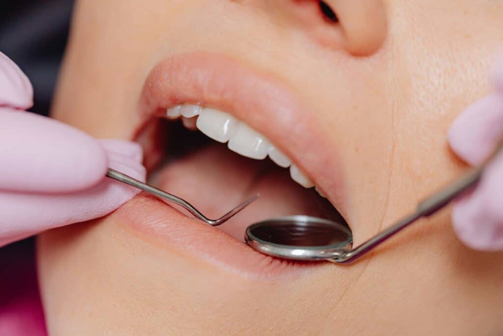 checking wisdom teeth on patient