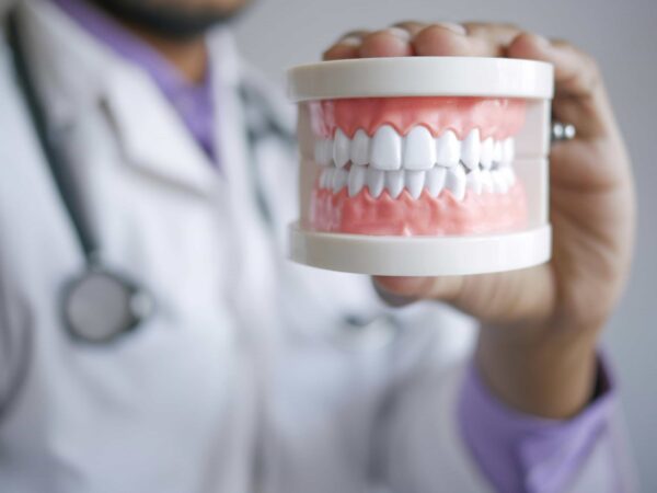 model of teeth